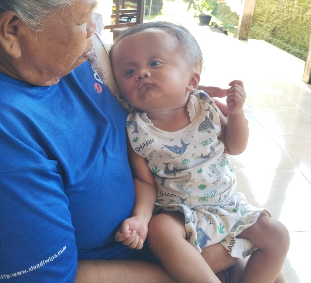 kondisi pilu bayi rafka penderita hidrosefalus di donorojo jepara